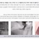 연세올바른치과의원 네이버블로그