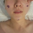 김포 운양동 피부관리 오롯이미 윤곽케어 두피 림프관리까지 함께