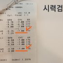 오렌즈(송파점)안경 | 하드렌즈 장점! 하드렌즈로 7디옵터 고도 난시 완벽 교정~