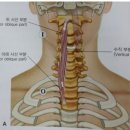 세광밸런스TC 이미지