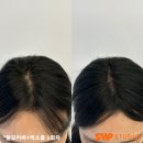[SMP STUDIO 일산] 내돈내산 엑소좀+탈모커버 리얼후기
