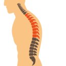 역삼생생본의원·한의원 | 역삼역 정형외과 생생본_통증은 왜 반복될까요?