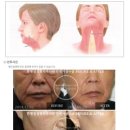 한형일성형외과의원 이미지