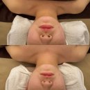 테크노메디컬타워 서편 | 대구 신부관리 빛의 전신, 현풍 마사지 얼굴 축소관리