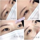 아띠브로우 | 광주아이라인문신 리터치후기