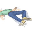 저나트륨혈증[Hyponatremia] 이미지