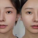 삼성동눈썹문신 자연스럽게 바뀐 후기｜엘케이뷰티엑시스 강남본점 방문