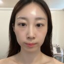 위너스케어 | 김해피부관리 빈스뷰티 슈퍼젝션 후기 색소 잡티 케어 재방문 솔직 후기