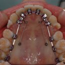 가지런이치과교정과치과의원 이미지