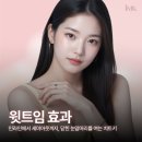 앞트임 윗트임 비교 : 장원영 제니 세미아웃라인의 비밀, 윗트임 효과로 눈앞머리 열기