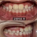 아이로움키즈치과의원 이미지