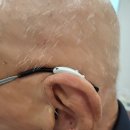 제일보청기 이미지