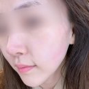 약손명가구리점 얼굴 맞춤관리 받고 만족한 찐 후기
