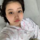 비염수술, 충농증 수술 경험담/과정/후기, 코 물혹제거 수술 [코 충농증 통증/가격/병원] 1