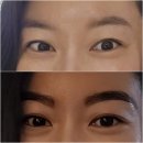 광주 눈썹 반영구 북구 양산동 첨단 눈썹문신 제거 잘하는곳 유니뷰티크