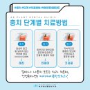 에이케이플란트치과의원 이미지