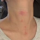 새솔외과의원 | 새솔외과의원(화상치료전문병원/주차장/위치/2도화상)