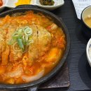 여자 | 2026 담낭절제술 쓸개제거수술 단일공 복강경 20대 여자 후기 #5