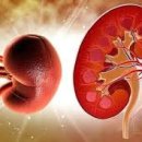 신장 결핵[renal tuberculosis] 이미지