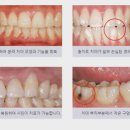 연세제일치과의원 네이버블로그
