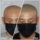 프로스칼프부산 이미지