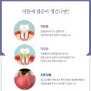 서울하우치과 이미지