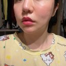 큰시장한의원 | 부산턱관절교정 한의원 3차 치료 받으며 호전되어가는 후기