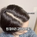 씨제이올리브영(주)세종대평점 | 이런 변화 보셨을까요? 저도 깜짝 놀랐어요! 머리카락 있을 때 지키세요!!^^