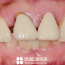 연세다감치과의원 네이버블로그