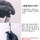 드메이(demei) - 안양시 동안구 | [드메이] 핀젤(PIN GEL) 주사기 개봉기