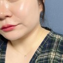 청담 피부과에서 통증 없는 스킨부스터 시너젯케어 받고 온 리얼 후기