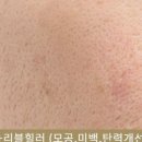 수림스킨케어샵 네이버블로그