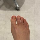 레푸스앤네일 | 대전 유성 레푸스 앤 네일맘에서 내성,무좀발톱 케어 직접 받은 후기