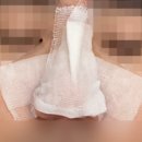 블랙헤드포기하지않는방법, 포기하고싶던 블랙헤드로부터 해방된 후기