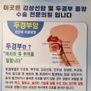 수호홍삼 | 갑상선암 명의 고주파치료, 서울 갑상선명의 이용식이비인후과 YES 아산병원 갑상선고주파 NO