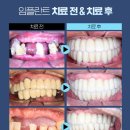 강남애프터치과 이미지