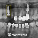 서울하이탑치과의원 이미지