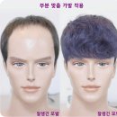서정리가발
