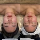 온아르스킨 | 남포동피부관리 온아르스킨 아르윤곽리프팅케어