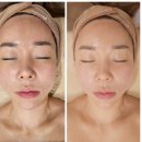 명 | 미사경락 명윤곽 후기, 통증 없는 수기 윤곽관리