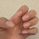 포도네일 - 안양시 동안구 | [후기] 오호라 네일 강화제 포도 vs 피치 & 반디 영양제 내돈내산 비교후기