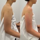수원 바디관리 :: 에스테틱 다리아 싹뺀다 팔뚝관리로 미운 군살 타파하고 온 솔직후기