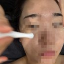 태암로 | 구암동 피부관리샵 당신의 뷰티 대구 칠곡 여드름 관리 후기