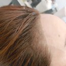 장헤어라인 - 아산시 | 장헤어라인