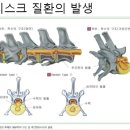동물진료법인피케이동물병원 | 인천동물병원 강아지 디스크 – 조기 치료가 답입니다