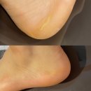 현우토탈인테리어 | 주안 왁싱 퀸덤뷰티 패디플래닝 비포애프터