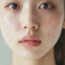멜로우피부과의원 네이버블로그