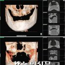 입속 다양한 세균이 치주질환 유발…당뇨병 등 발생 위험 높여 이미지