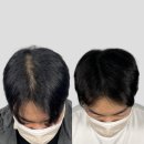 채도스칼프 이미지