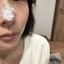 해율한의원 - 마포구 양화로 166 | 광주[해율한의원]새살침 후기